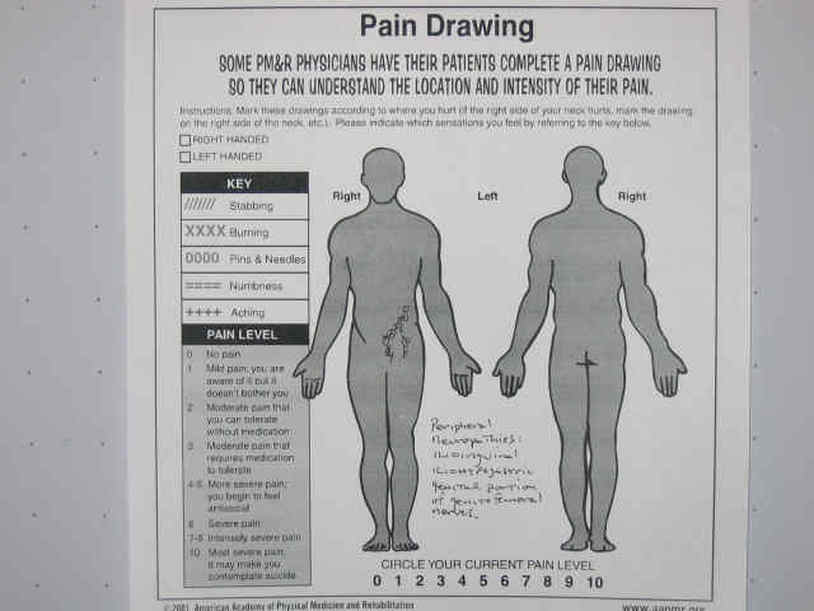 Hesch Institute Superficial Traumatic Neuropathies Pain Drawing